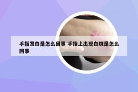 手指发白是怎么回事 手指上出现白斑是怎么回事