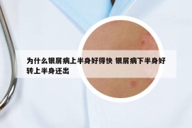 为什么银屑病上半身好得快 银屑病下半身好转上半身还出