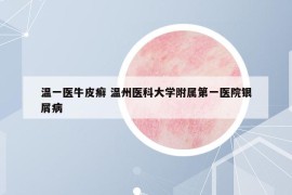 温一医牛皮癣 温州医科大学附属第一医院银屑病