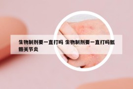 生物制剂要一直打吗 生物制剂要一直打吗骶髂关节炎