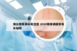 烟台银屑病补助流程 2020银屑病国家有补贴吗