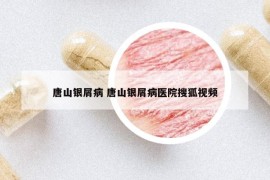 唐山银屑病 唐山银屑病医院搜狐视频
