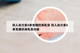 抗人白介素8单克隆抗体乳膏 抗人白介素8单克隆抗体乳膏价格