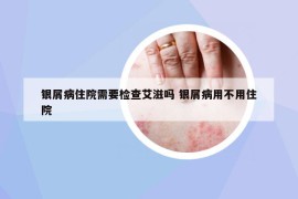 银屑病住院需要检查艾滋吗 银屑病用不用住院