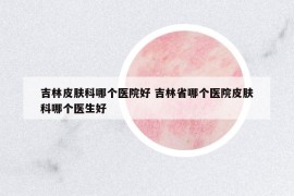 吉林皮肤科哪个医院好 吉林省哪个医院皮肤科哪个医生好