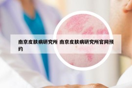 南京皮肤病研究所 南京皮肤病研究所官网预约