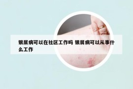 银屑病可以在社区工作吗 银屑病可以从事什么工作