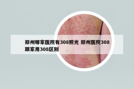 郑州哪家医院有308照光 郑州医院308跟家用308区别