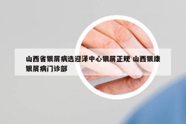山西省银屑病选迎泽中心银屑正规 山西银康银屑病门诊部
