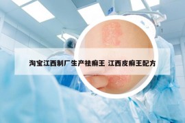 淘宝江西制厂生产祛癣王 江西皮癣王配方