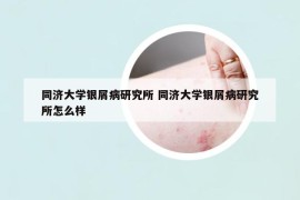 同济大学银屑病研究所 同济大学银屑病研究所怎么样