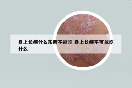 身上长癣什么东西不能吃 身上长癣不可以吃什么