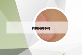 白癜风疼不疼