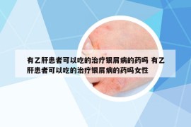 有乙肝患者可以吃的治疗银屑病的药吗 有乙肝患者可以吃的治疗银屑病的药吗女性