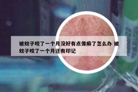被蚊子咬了一个月没好有点像癣了怎么办 被蚊子咬了一个月还有印记