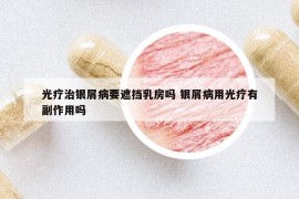 光疗治银屑病要遮挡乳房吗 银屑病用光疗有副作用吗