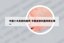 中国十大皮肤科医院 中国皮肤科医院排名第一