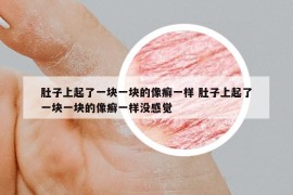 肚子上起了一块一块的像癣一样 肚子上起了一块一块的像癣一样没感觉