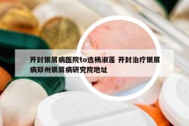 开封银屑病医院to选杨淑莲 开封治疗银屑病郑州银屑病研究院地址