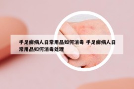手足癣病人日常用品如何消毒 手足癣病人日常用品如何消毒处理