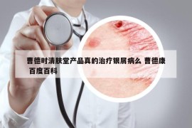 曹德时清肤堂产品真的治疗银屑病么 曹德康 百度百科