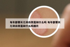 每年都要长几块白斑是缺什么吗 每年都要长几块白斑是缺什么吗图片