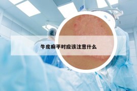 牛皮癣平时应该注意什么