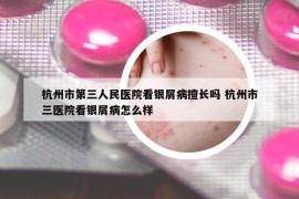 杭州市第三人民医院看银屑病擅长吗 杭州市三医院看银屑病怎么样