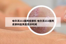 哈尔滨211医院皮肤科 哈尔滨211医院皮肤科赵凤莲出诊时间