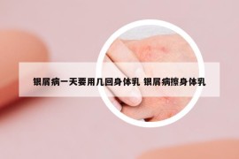 银屑病一天要用几回身体乳 银屑病擦身体乳