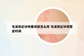 屯溪世纪诊所看皮肤怎么样 屯溪世纪诊所营业时间