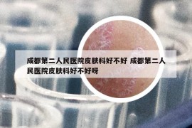 成都第二人民医院皮肤科好不好 成都第二人民医院皮肤科好不好呀