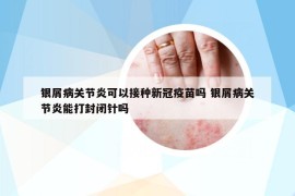 银屑病关节炎可以接种新冠疫苗吗 银屑病关节炎能打封闭针吗