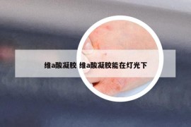 维a酸凝胶 维a酸凝胶能在灯光下