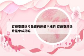 百癣夏塔热片是西药还是中成药 百癣夏塔热片是中成药吗