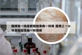 胳膊有一块皮肤粗糙像癣一样痒 胳膊上一小块很粗糙像癣一样很痒