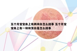 五个月宝宝身上有两块白怎么回事 五个月宝宝身上有一块块发白是怎么回事