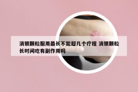 消银颗粒服用最长不能超几个疗程 消银颗粒长时间吃有副作用吗