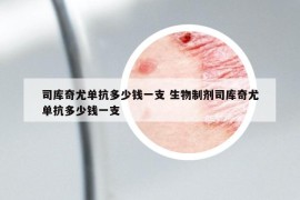 司库奇尤单抗多少钱一支 生物制剂司库奇尤单抗多少钱一支