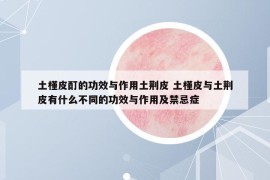 土槿皮酊的功效与作用土荆皮 土槿皮与土荆皮有什么不同的功效与作用及禁忌症