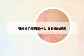 引起癣的原因是什么 导致癣的原因