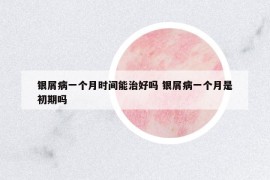 银屑病一个月时间能治好吗 银屑病一个月是初期吗