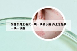 为什么身上会长一块一块的小藓 身上总是长一块一块癣