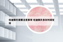 吃迪银片需要注意事项 吃迪银片多长时间见效