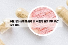 中医泡浴治银屑病疗法 中医泡浴治银屑病疗法有效吗