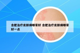 合肥治疗皮肤病哪家好 合肥治疗皮肤病哪家好一点