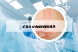 蛇盘疮 蛇盘疮的初期症状