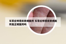 石家庄明德皮肤病医院 石家庄明德皮肤病医院是正规医院吗