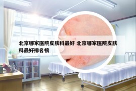 北京哪家医院皮肤科最好 北京哪家医院皮肤科最好排名榜