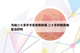 为啥二十多岁才出现银屑病 二十年的银屑病能治好吗